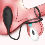 Double Ring Rotation Vibrates the Plug 10 Patterns Powerful Vibration Remote Control Modes Plug Massager for Male - 图片 4